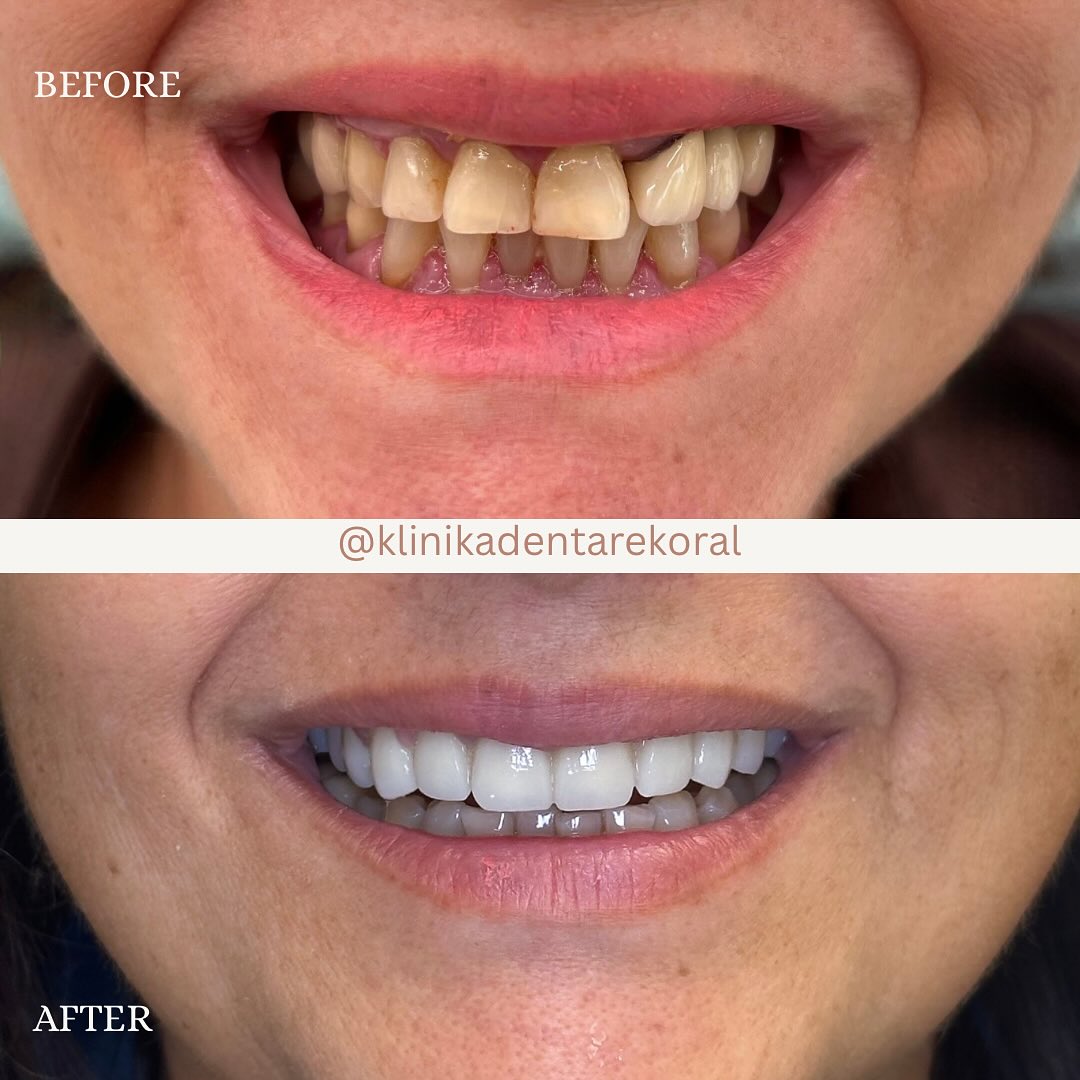 566961662_18068482646249901_4793396379429511054_n